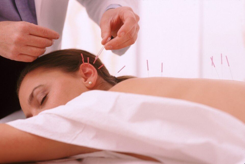 Acupunctură și acupunctură cu osteocondroză cervicală