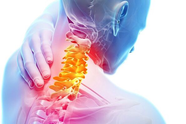 Cauzele osteochondrozei cervicale