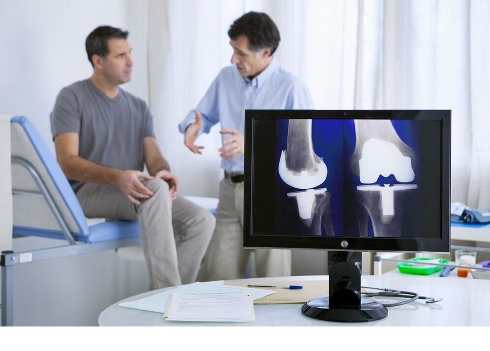 Arthroza articulației genunchiului în imaginea x -ray